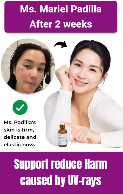 Bakuchiol Retinol Anti Aging Whitening，Renewing Skin Reduce Melasma，Freckles Fading Dark Spots