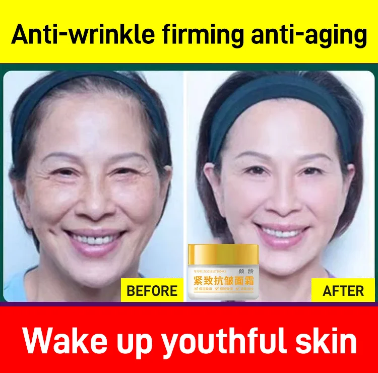 NO.1 Popular Anti Aging Face Cream